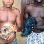 Bénin trafic d’organes