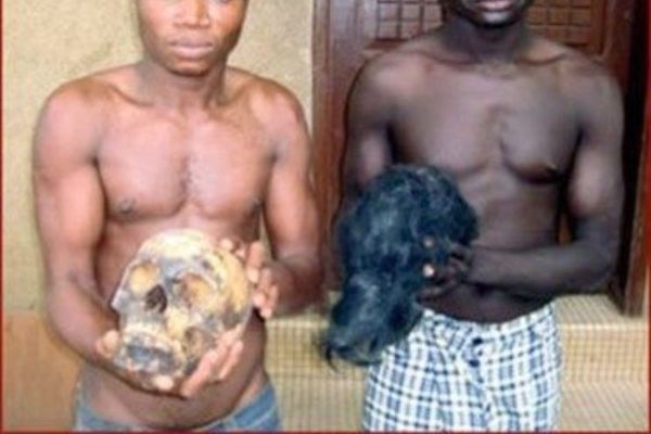 Bénin trafic d’organes